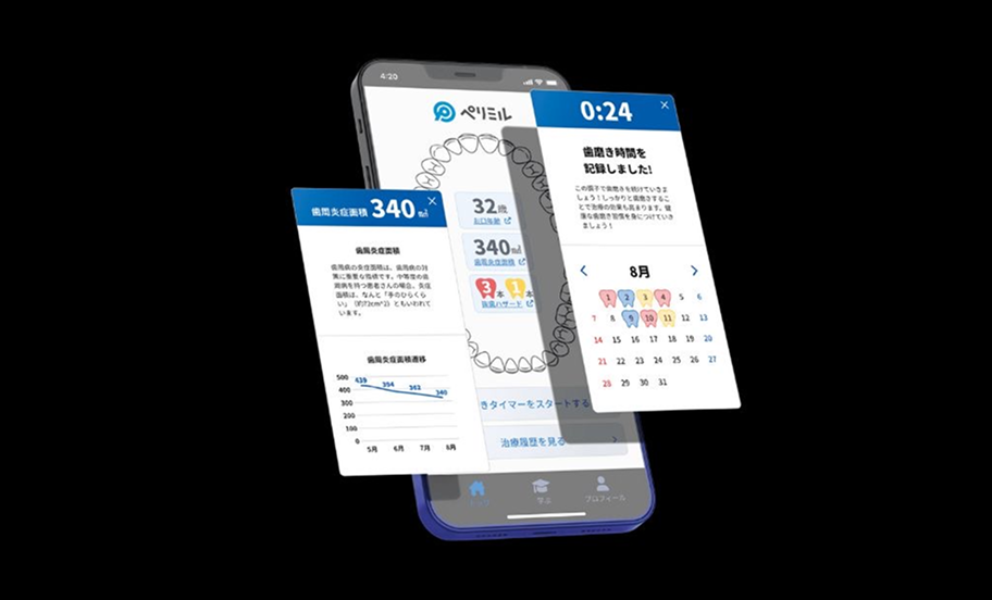 アプリ「ペリミル」と併用で再発予防